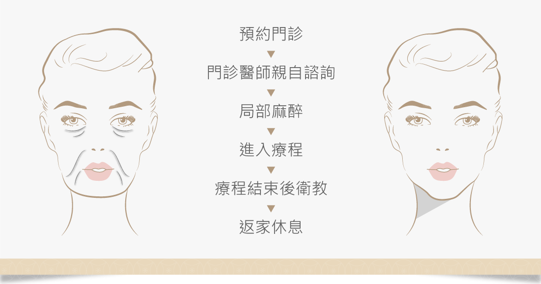洢蓮絲治療流程