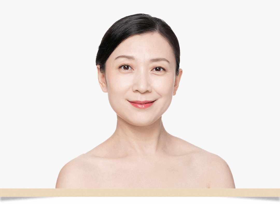 拉皮手術