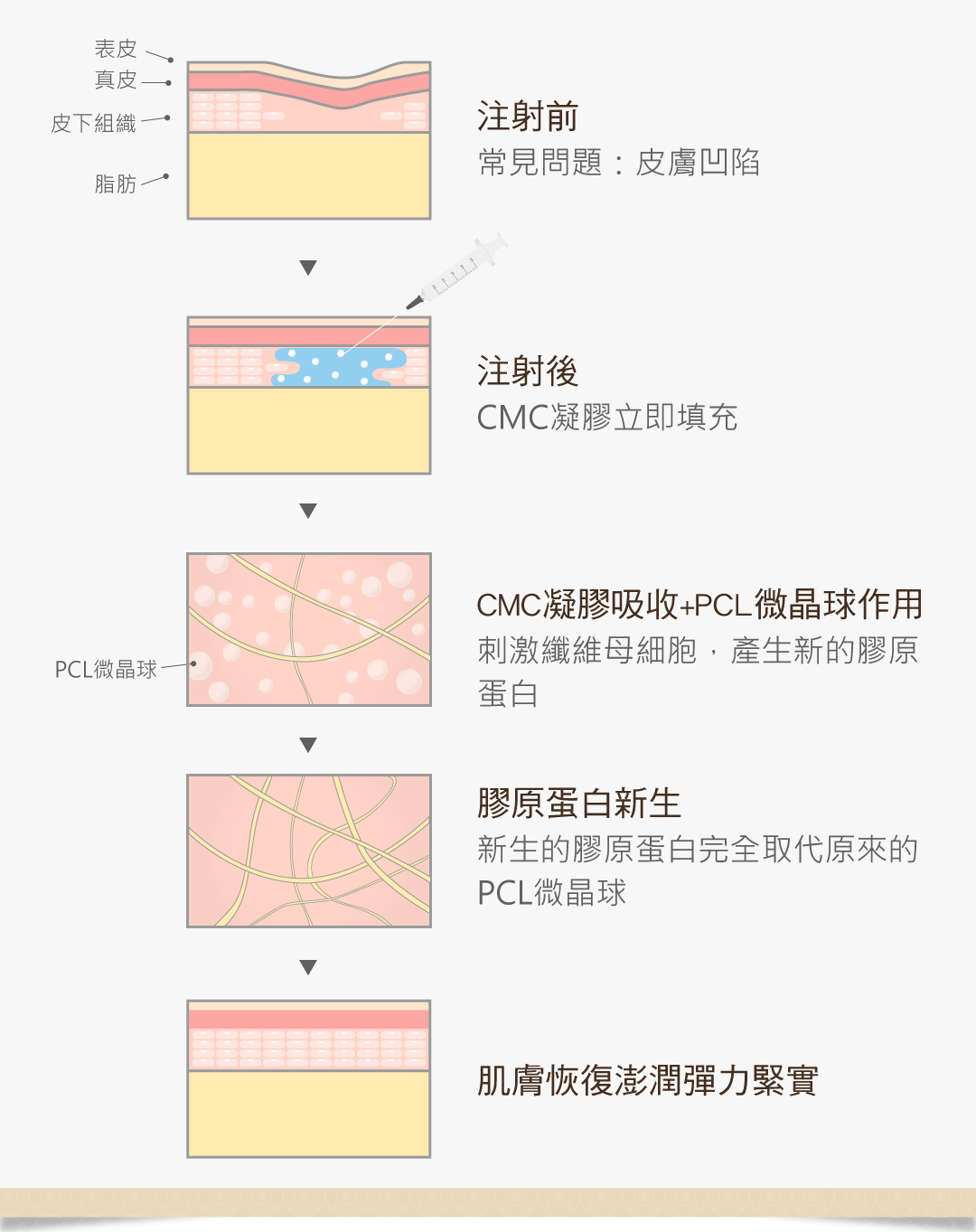皮膚凹陷