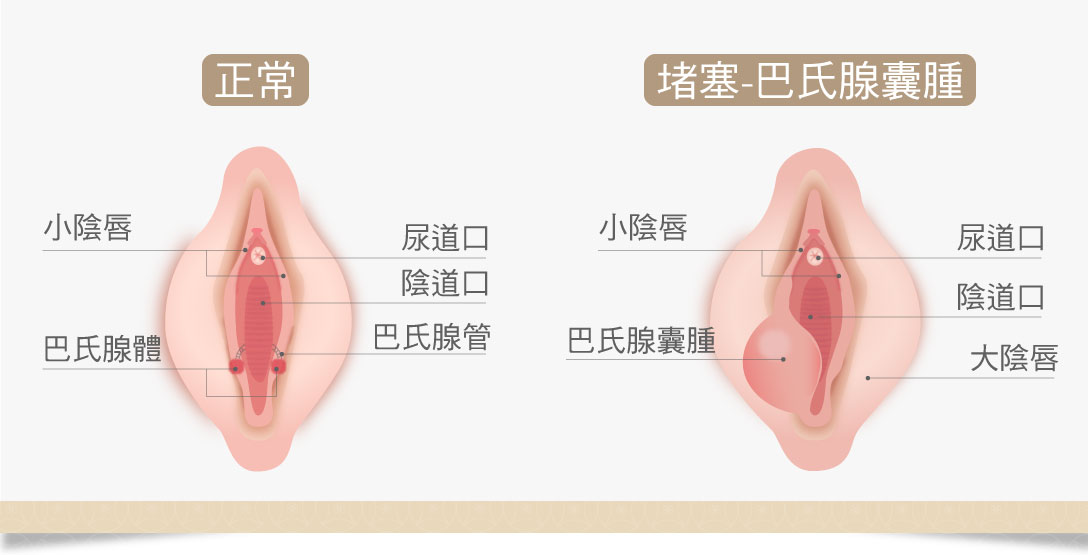 妹妹腫起來