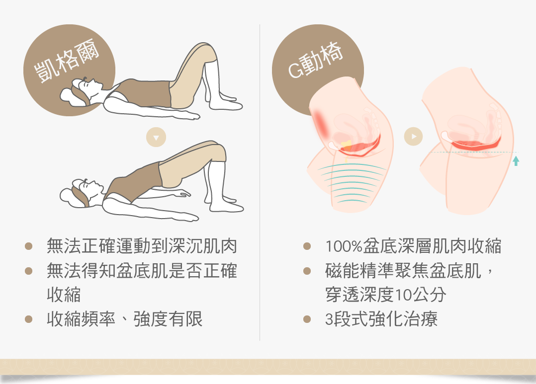 凱格爾運動 G動椅