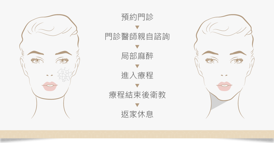 水光槍治療流程