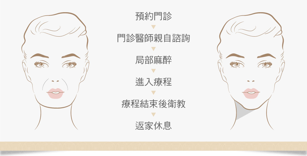 埋線拉提流程