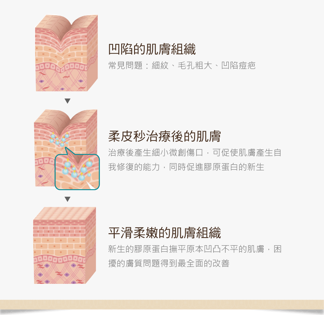 膠原蛋白流失